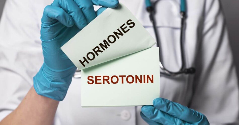 can lsd cause serotonin syndrome